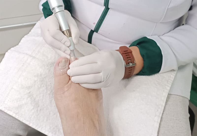 5 Sinais de que você precisa de um Podólogo e não apenas de uma Pedicure